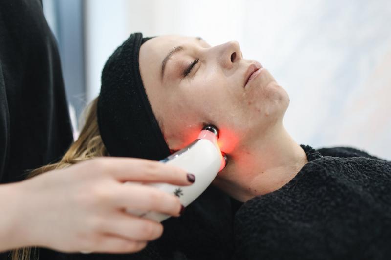 6 Vantagens do Tratamento a Laser para Cicatriz