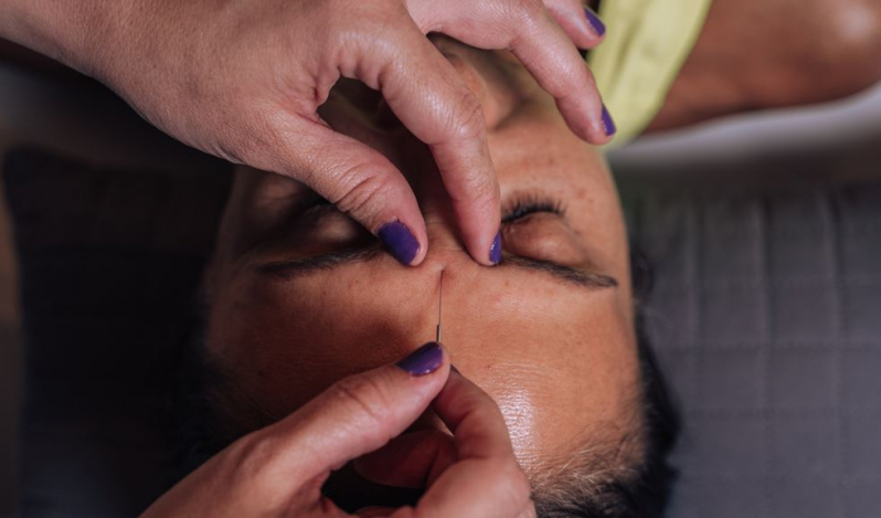 Acupuntura Facial Marcar Passo do Feijó - Acupuntura para Emagrecer