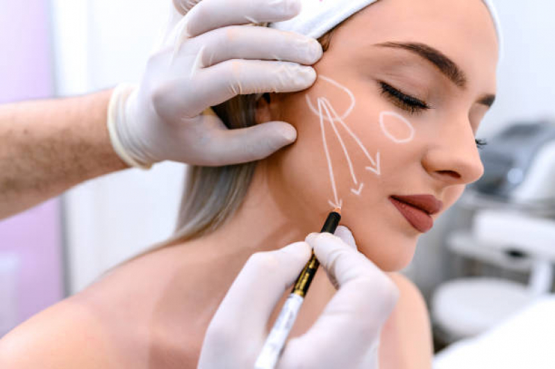 Clinica Especializada em Tratamento de Cicatriz de Acne Itai - Tratamento de Cicatrizes Porto Alegre