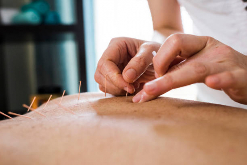 Sessão de Acupuntura na Orelha Condomínio Green Palm - Acupuntura Auricular