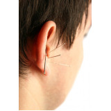 acupunturas na orelha agendar Hípica