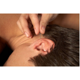 acupunturas na orelha Areal