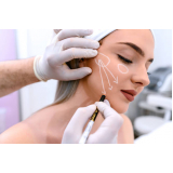 clinica especializada em tratamento de cicatriz de acne Boa Vista