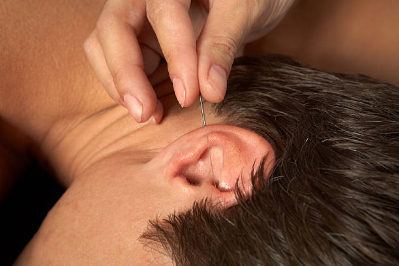 acupunturas-na-orelha